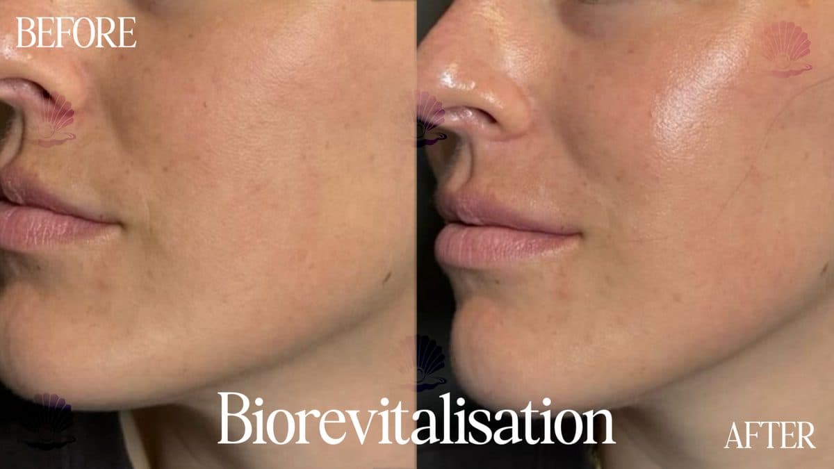 Face — skin glow restored