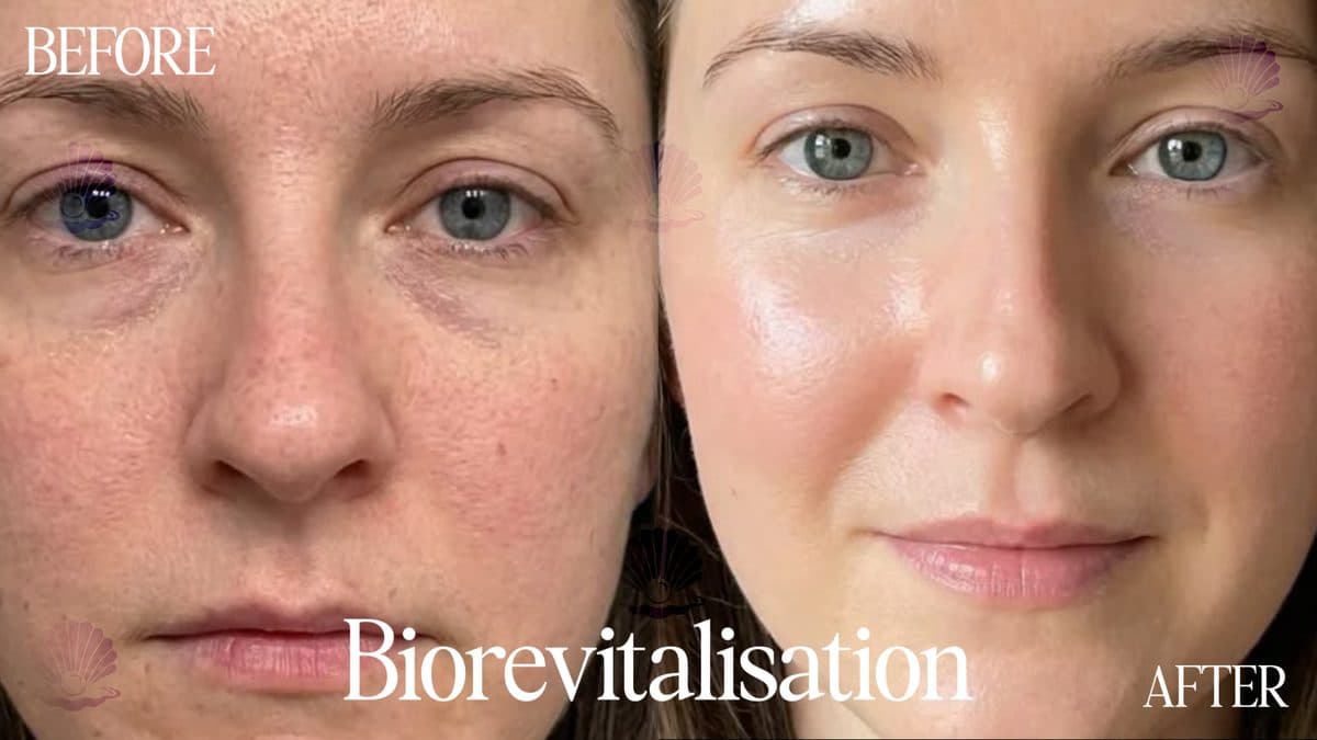 Face — tone & hydration