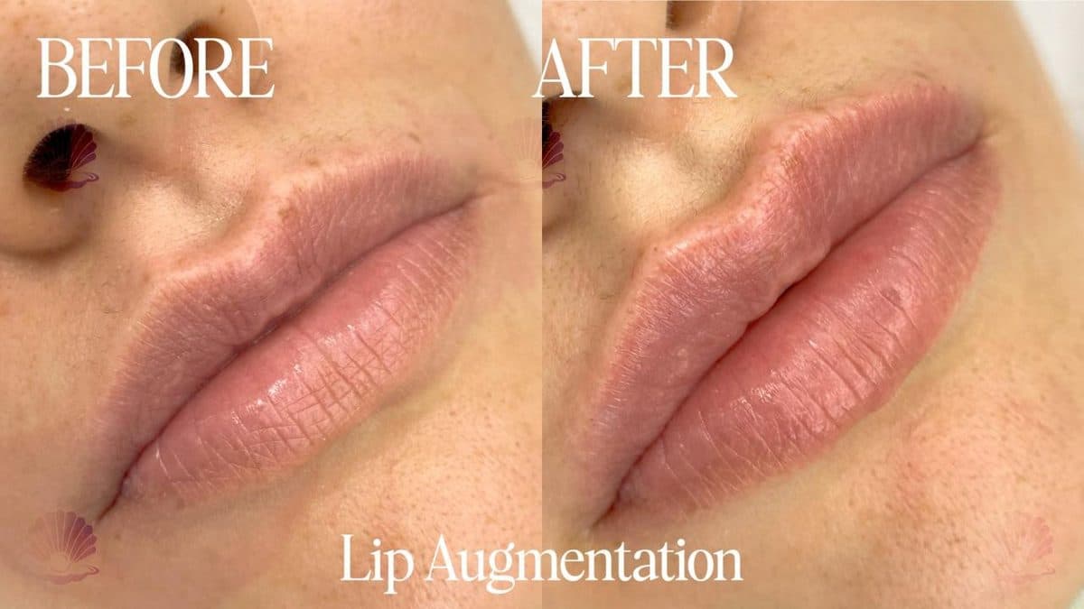 Lips — lip border defined
