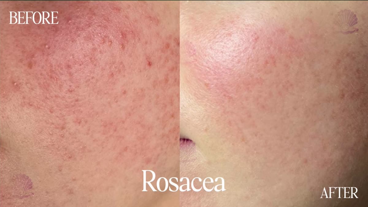 Sensitive, reactive skin