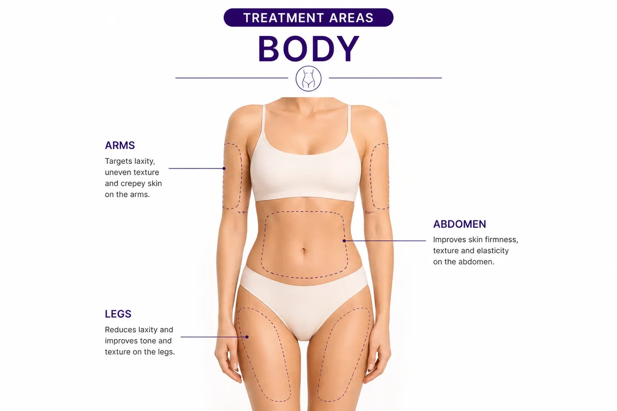The body treatment areas