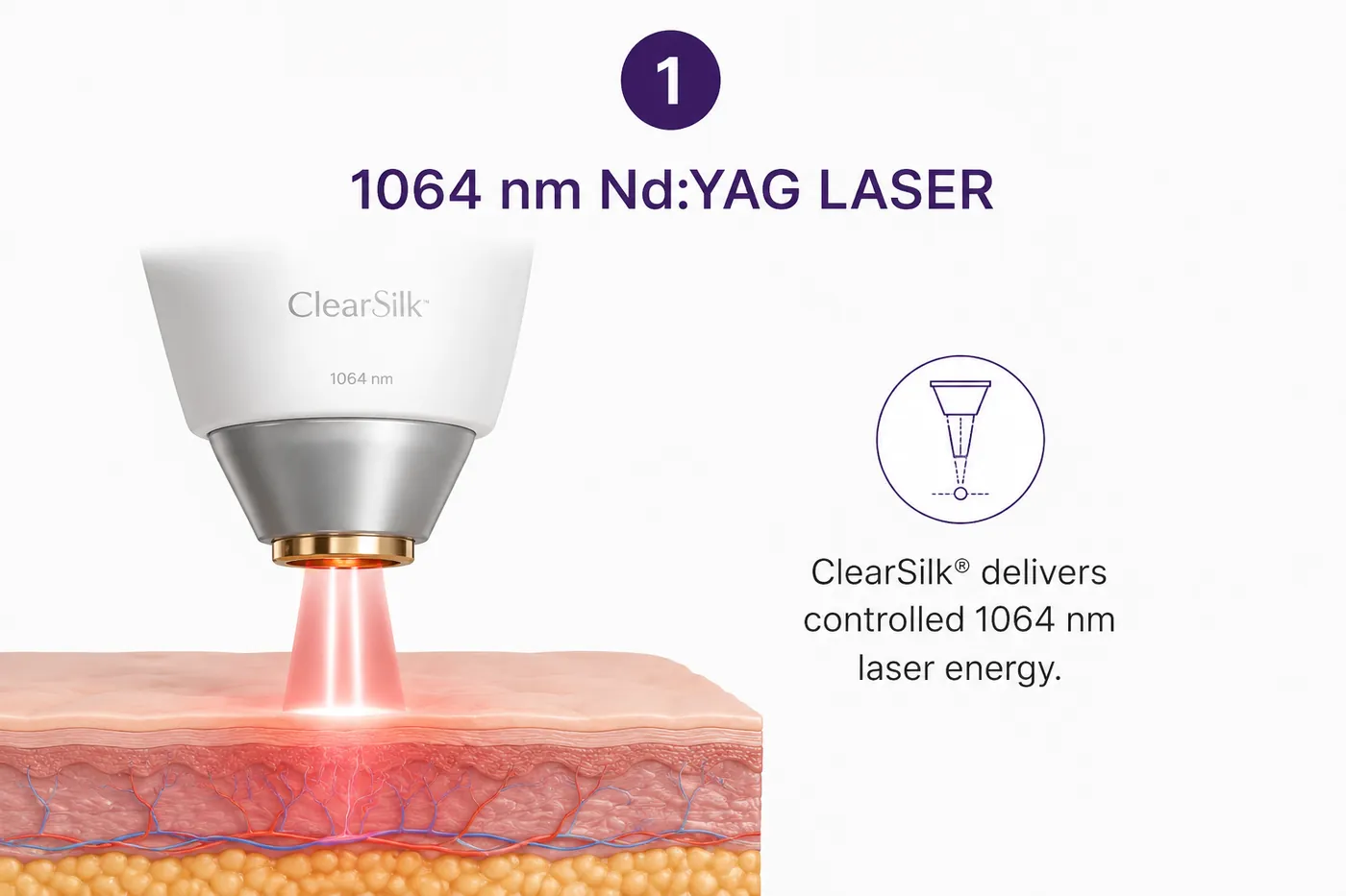 Step one, the handpiece delivering 1064 nm energy into a cross section of skin