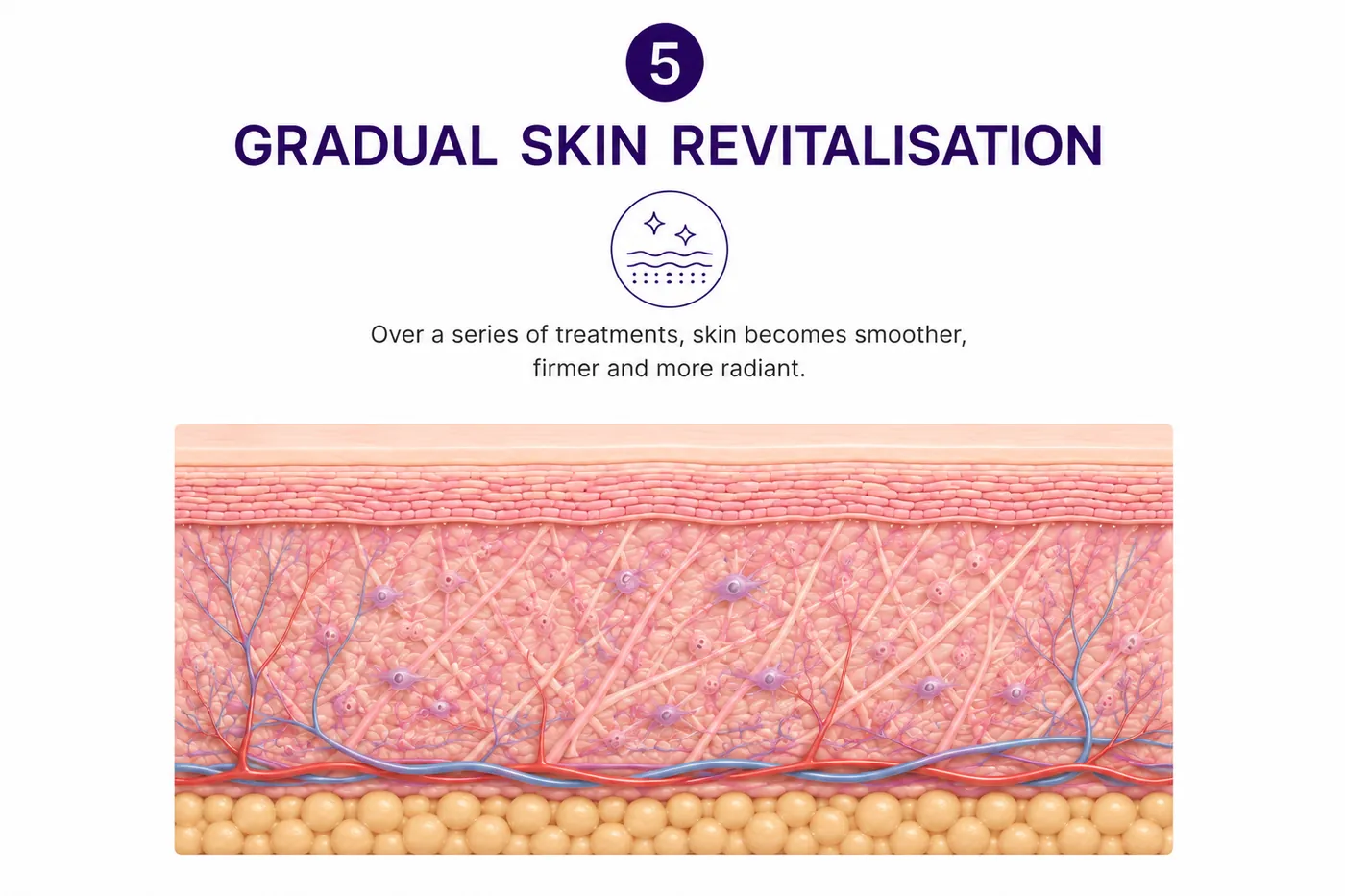 Step five, a cross section of revitalised skin after a course of treatments