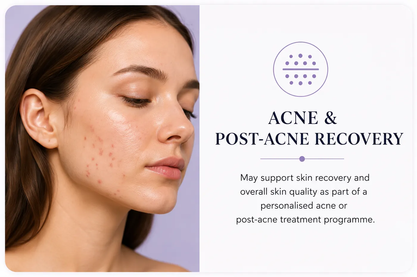 Her acne and post-acne recovery card, with her icon, title and caption