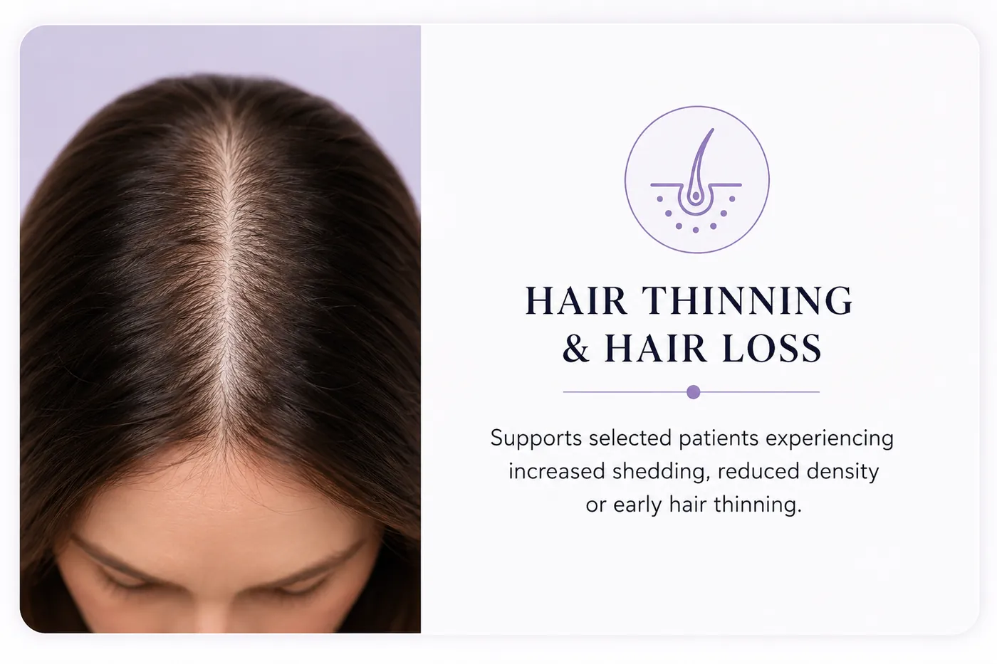 Her hair thinning and hair loss card, the parting photograph with her icon, title and caption
